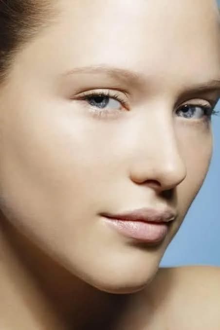 Photofacial & IPL Treatment Cost in Gurgaon | Profrea